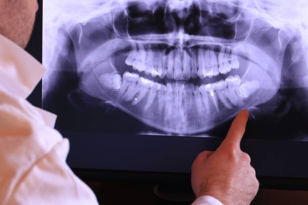 Best Emergency Gum Treatment in Pleasant Run, OH